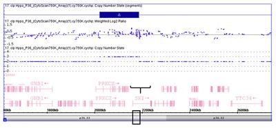 Identification of Copy Number Variation Among Nonsyndromic Cleft Lip and or Without Cleft Palate With Hypodontia: A Genome-Wide Association Study